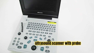 Equipo médico Saferlife Escáner de ultrasonido